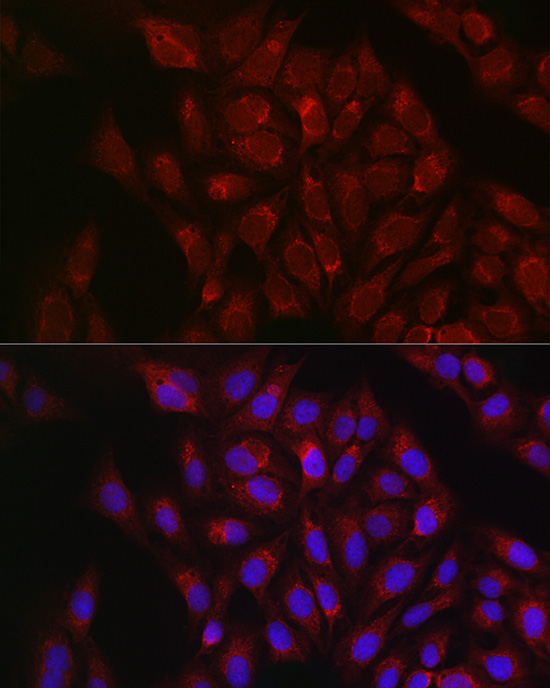 RBCK1 Rabbit Polyclonal Antibody - Image 2