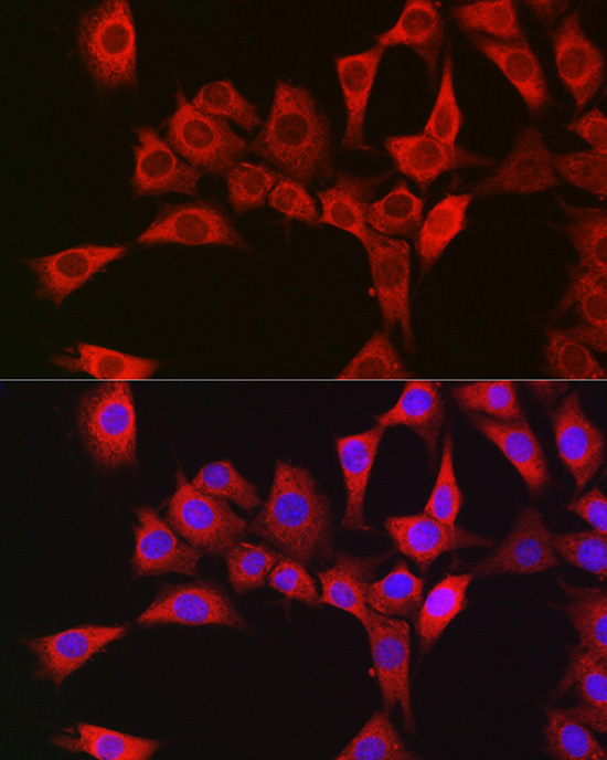 RBCK1 Rabbit Polyclonal Antibody - Image 3