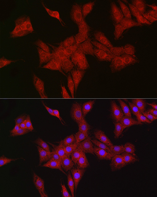 RBCK1 Rabbit Polyclonal Antibody - Image 4