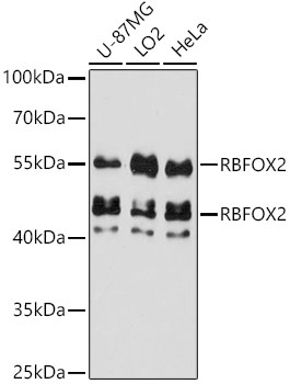 RBFOX2 Rabbit Polyclonal Antibody