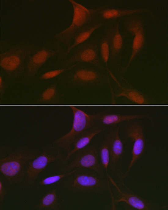 RBL2 Rabbit Polyclonal Antibody - Image 2