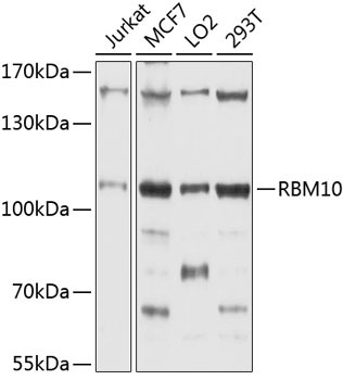 RBM10 Rabbit Polyclonal Antibody