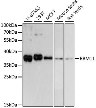 RBM11 Rabbit Polyclonal Antibody