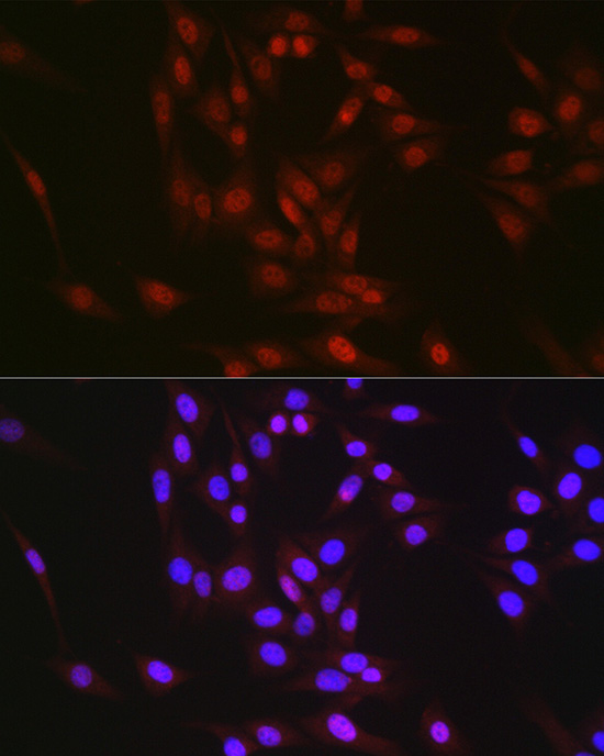 RBM14 Rabbit Polyclonal Antibody - Image 2