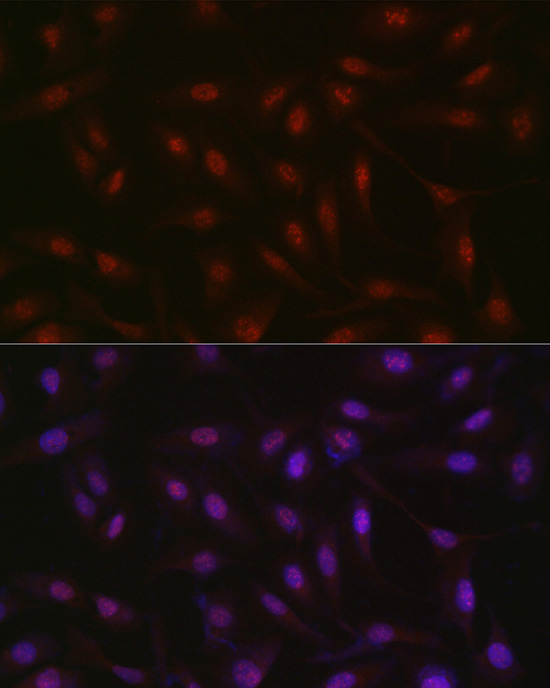 RBM14 Rabbit Polyclonal Antibody - Image 3