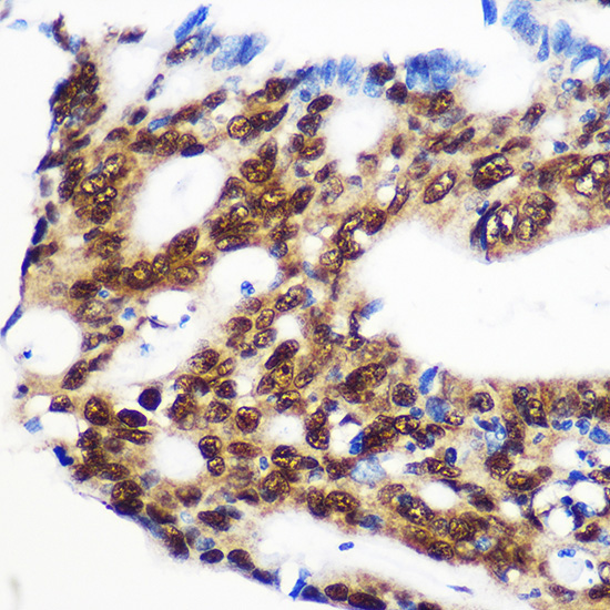RBM15 Rabbit Polyclonal Antibody - Image 2