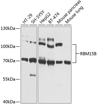 RBM15B Rabbit Polyclonal Antibody