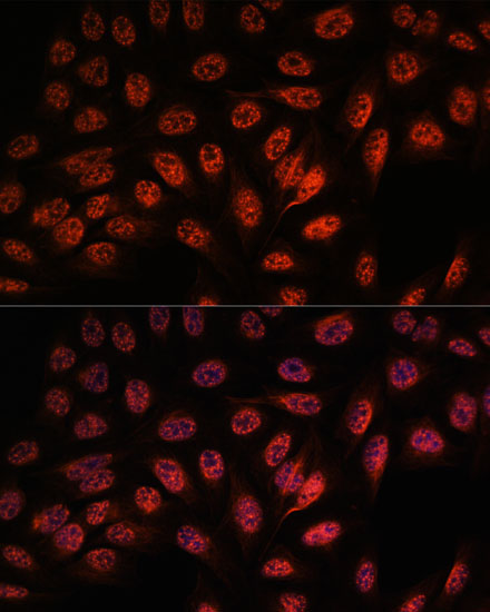 RBM25 Rabbit Polyclonal Antibody - Image 2