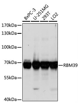 RBM39 Rabbit Polyclonal Antibody