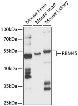 RBM45 Rabbit Polyclonal Antibody