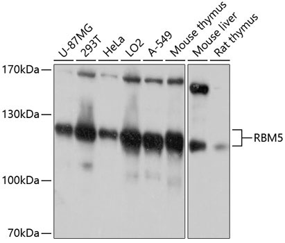 RBM5 Rabbit Polyclonal Antibody