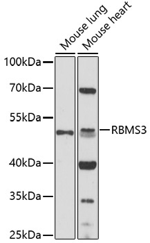 RBMS3 Rabbit Polyclonal Antibody