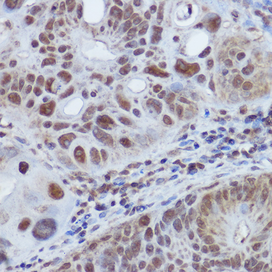 RBMY1A1 Rabbit Polyclonal Antibody