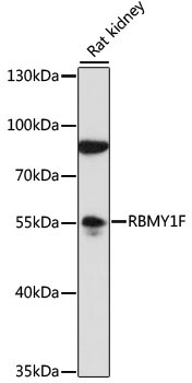 RBMY1F Rabbit Polyclonal Antibody