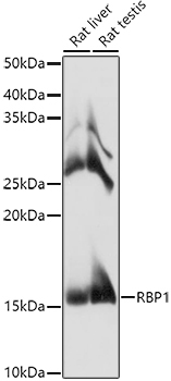RBP1 Rabbit Polyclonal Antibody