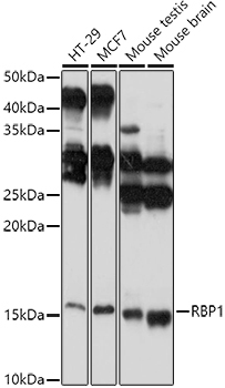 RBP1 Rabbit Polyclonal Antibody - Image 2