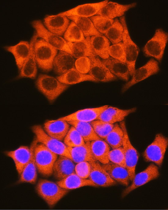 RBP1 Rabbit Polyclonal Antibody - Image 3