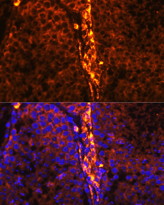 RBP1 Rabbit Polyclonal Antibody - Image 4