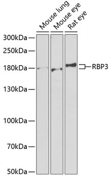 RBP3 Rabbit Polyclonal Antibody