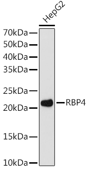 RBP4 Rabbit Monoclonal Antibody