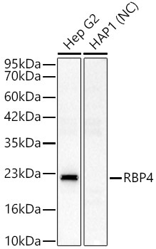 RBP4 Rabbit Polyclonal Antibody