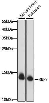 RBP7 Rabbit Polyclonal Antibody
