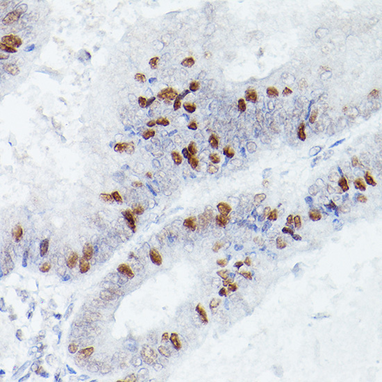 RBPJK Rabbit Monoclonal Antibody - Image 2