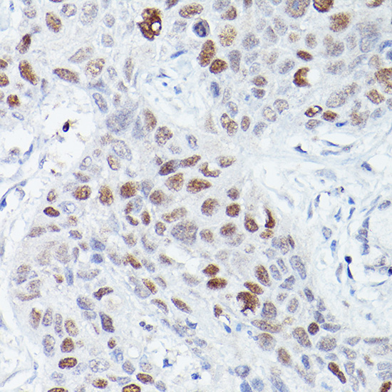 RBPJK Rabbit Monoclonal Antibody - Image 3