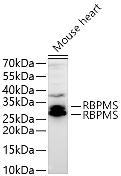 RBPMS Rabbit Polyclonal Antibody