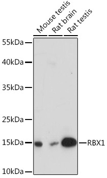 RBX1 Rabbit Polyclonal Antibody