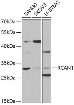 RCAN1 Rabbit Polyclonal Antibody