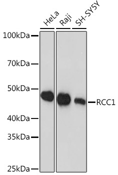 RCC1 Rabbit Monoclonal Antibody