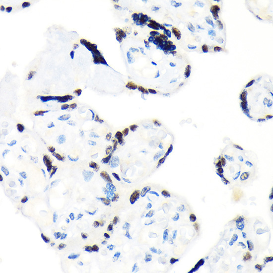 RCC1 Rabbit Monoclonal Antibody - Image 3