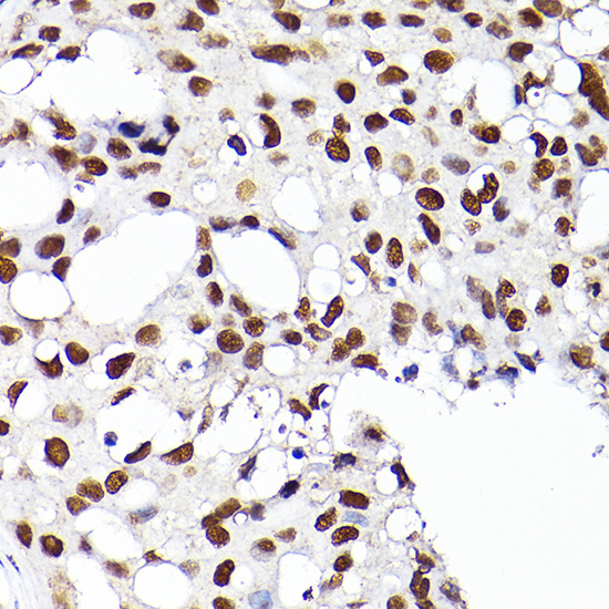 RCC1 Rabbit Polyclonal Antibody - Image 2