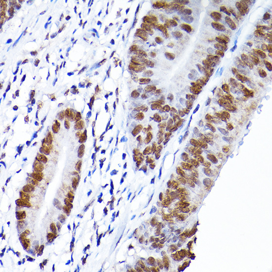 RCC1 Rabbit Polyclonal Antibody - Image 3