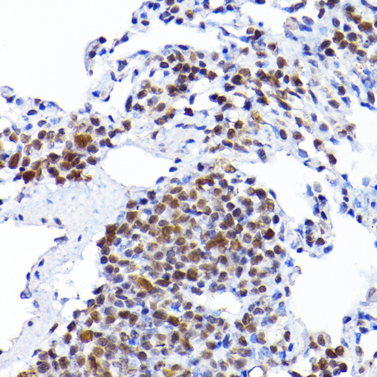 RCC1 Rabbit Polyclonal Antibody - Image 4
