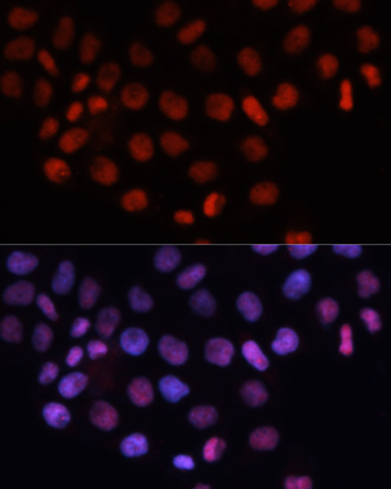 RCC1 Rabbit Polyclonal Antibody - Image 5