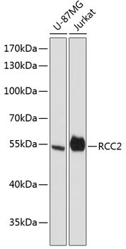 RCC2 Rabbit Polyclonal Antibody
