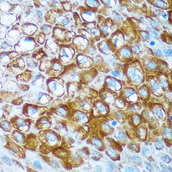 RCE1 Rabbit Polyclonal Antibody - Image 2