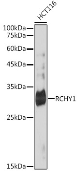 RCHY1 Rabbit Monoclonal Antibody