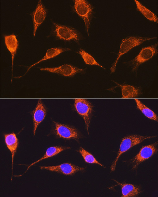 RCN1 Rabbit Polyclonal Antibody - Image 2