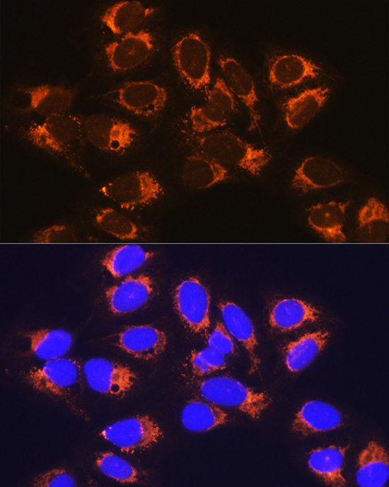 RCN1 Rabbit Polyclonal Antibody - Image 3