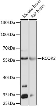 RCOR2 Rabbit Polyclonal Antibody
