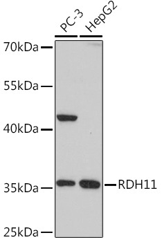 RDH11 Rabbit Polyclonal Antibody