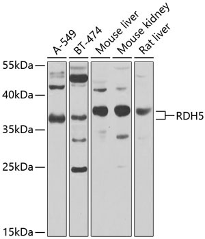 RDH5 Rabbit Polyclonal Antibody