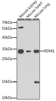 RDM1 Rabbit Polyclonal Antibody