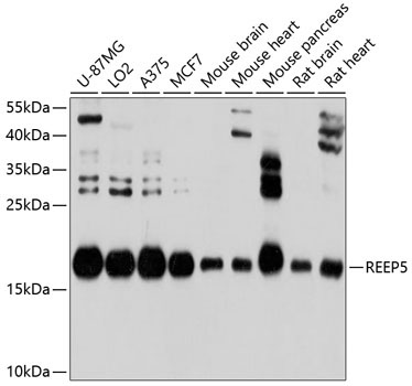 REEP5 Rabbit Polyclonal Antibody