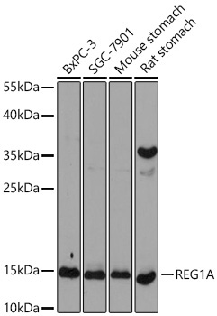 REG1A Rabbit Polyclonal Antibody