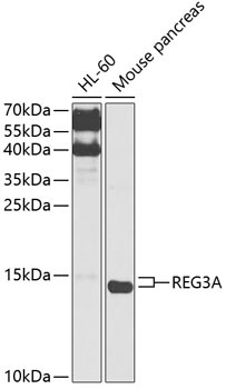 REG3A Rabbit Polyclonal Antibody