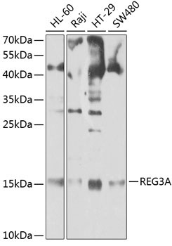 REG3A Rabbit Polyclonal Antibody